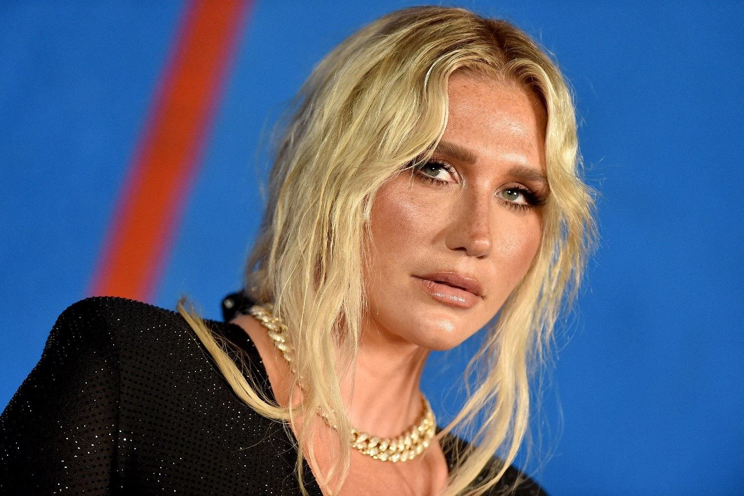 Η Kesha για το σοκ της επιτυχίας: «Βραχυκύκλωσε τον εγκέφαλό μου»