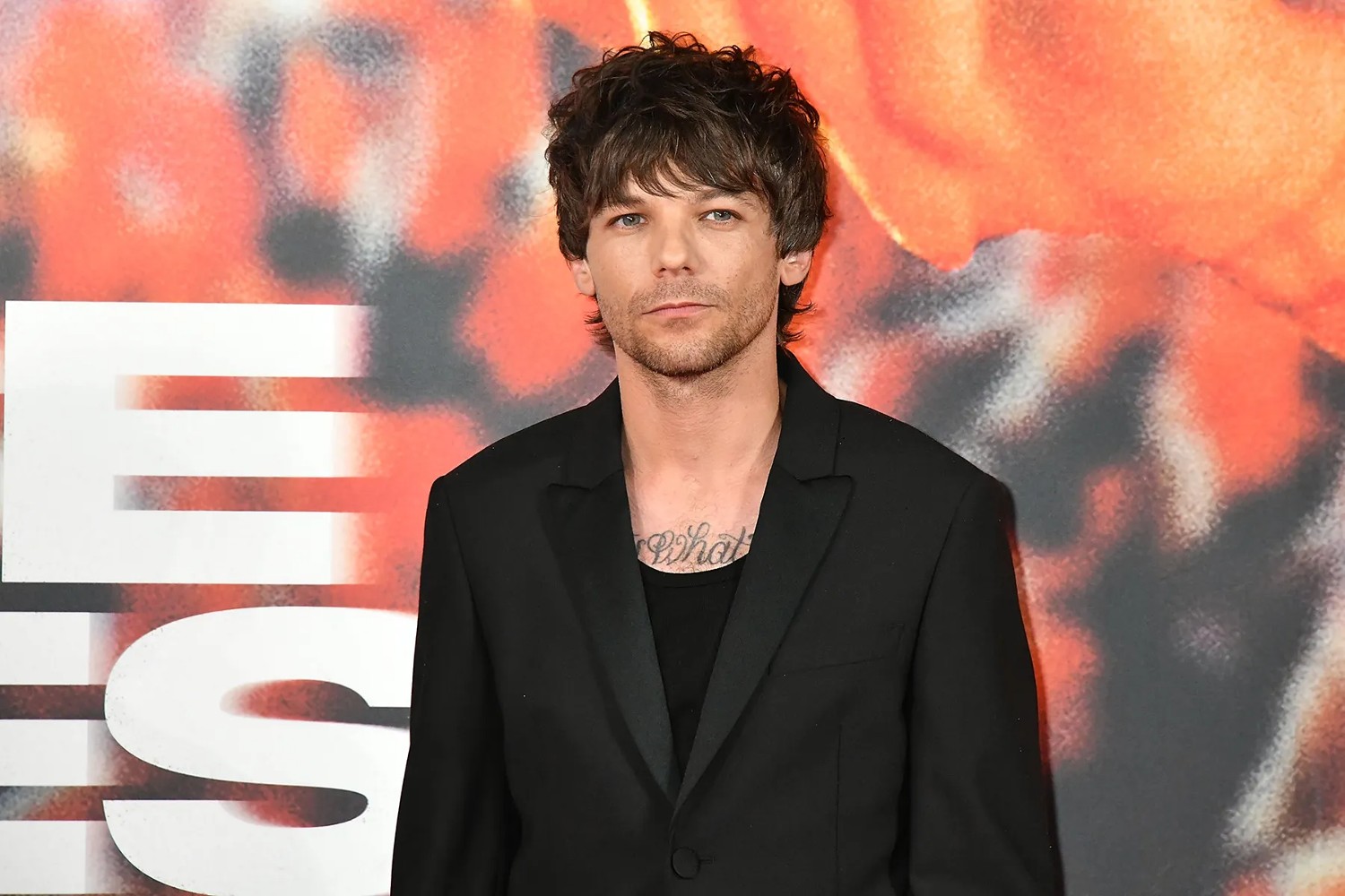 Louis Tomlinson: Η συγκινητική δωρεά για τον σωματοφύλακα των One Direction – Παλεύει με τον κίνδυνο ακρωτηριασμού