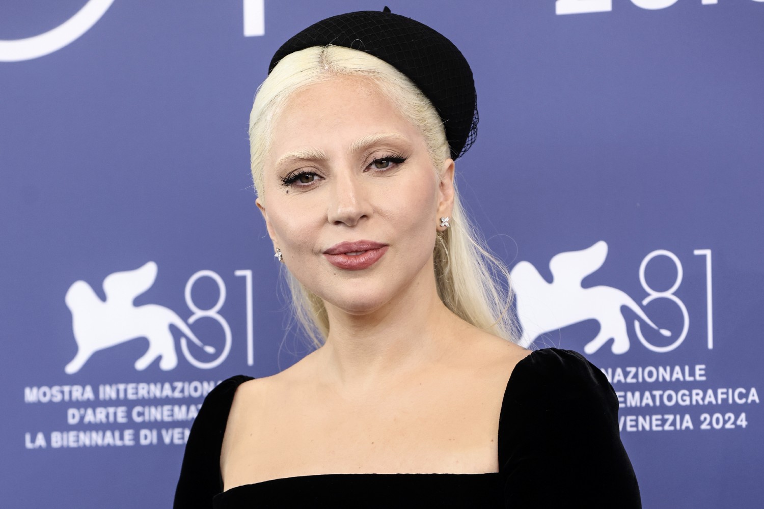 Η Lady Gaga έσκισε το σενάριο του «Joker: Folie à Deux»: «Ήταν απελευθερωτικό»