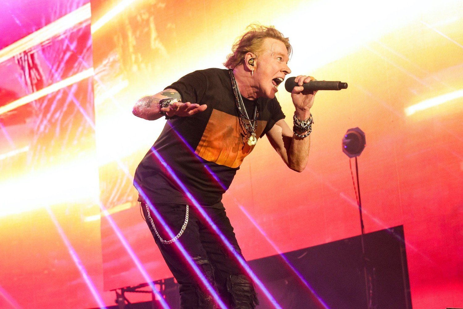 Guns N’ Roses: Ο Axl Rose αποκαλύπτει το πρόβλημα υγείας που τον δυσκολεύει στη σκηνή – «Φοβάμαι ότι η γνάθος μου θα πέσει»